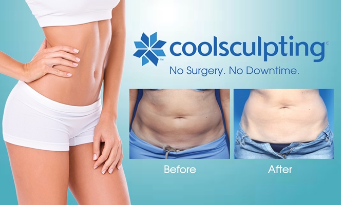 Coolsculpting Can Be Quite Beneficial For The People In Weight Loss! 