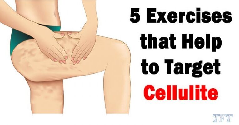 How To Get Rid Of Cellulite? Check Out The 4 Great Ways